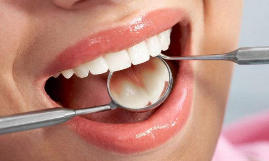 Как подготовиться к удалению зуба