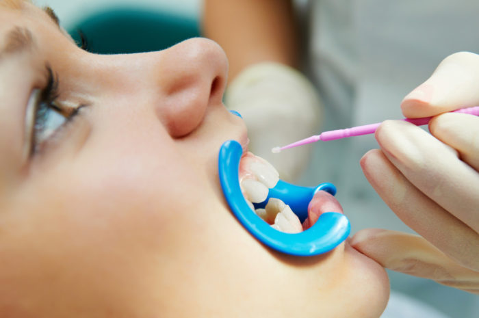 Как происходит лечение зубов у детей?