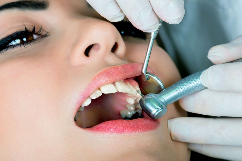 Лечение заболевшего зуба. Терапия стоматология.