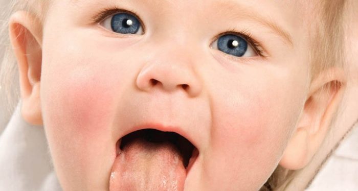 Язвочки на языке у ребенка фото