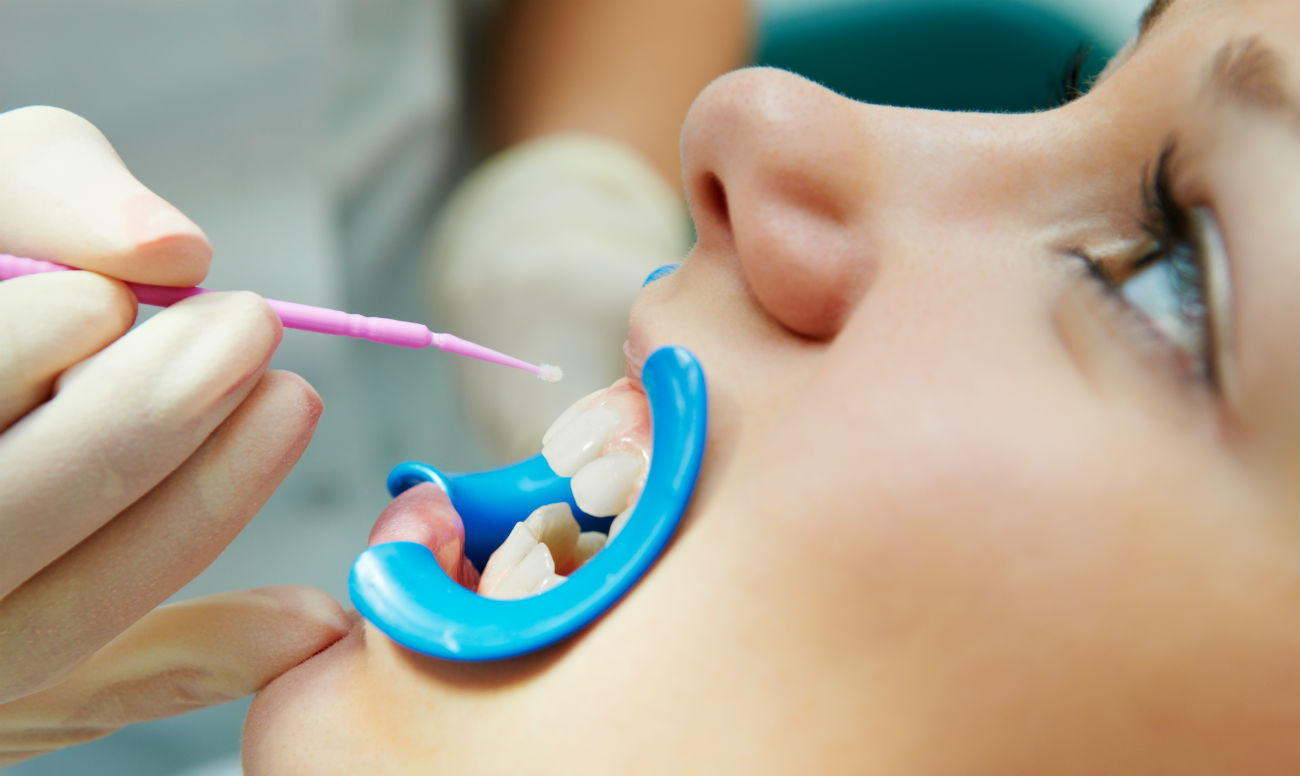 Почему могут гнить зубы у детей. Разбираем причины
