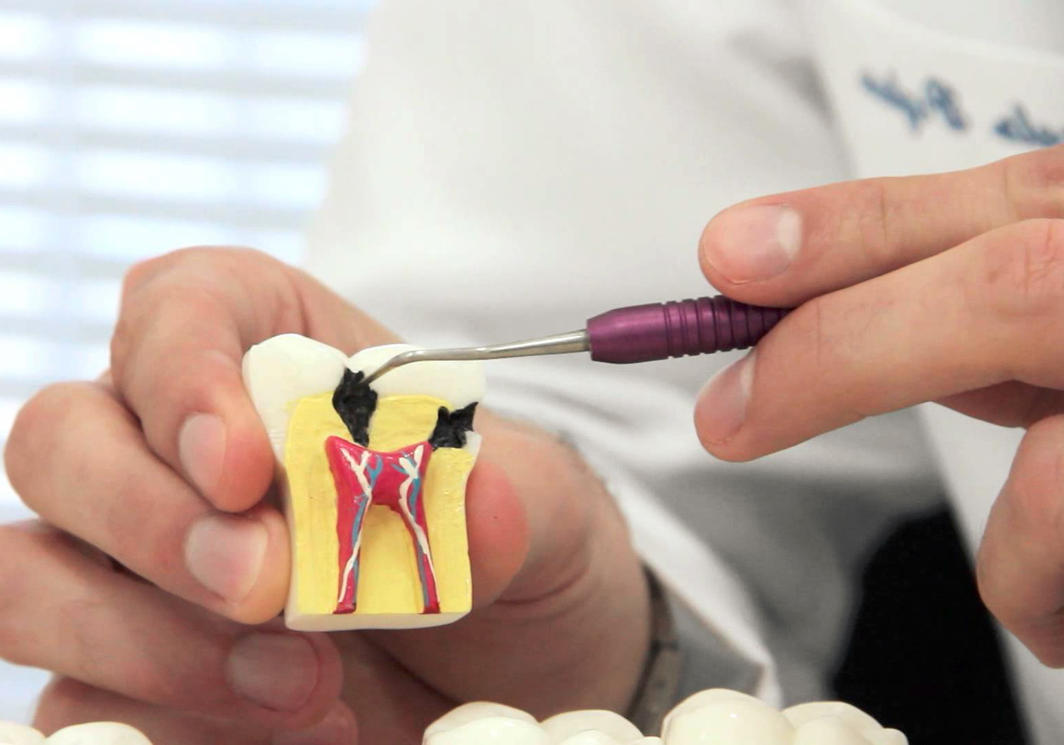Современная эндодонтия в стоматологии