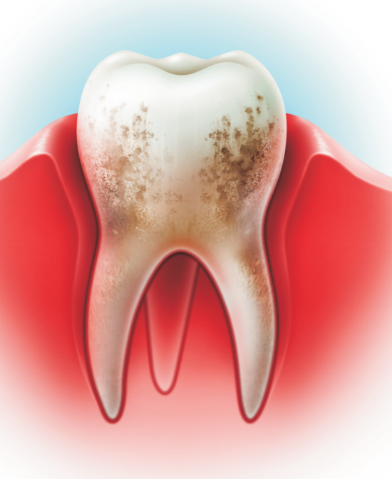 Чем укрепляют зубы и десна