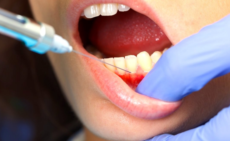 Больно ли лечить зубы
