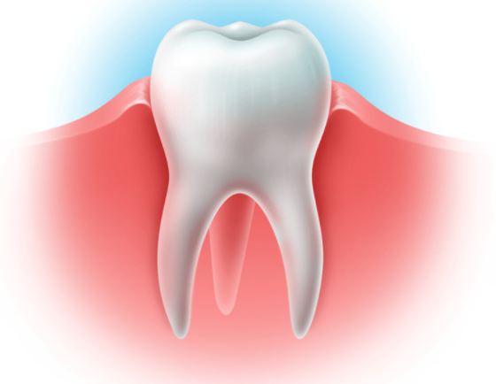 Перфорация зуба