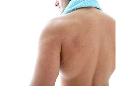 Как восстановить кожу спины
