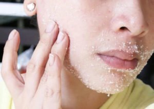 Влияние сахара на кожу лица