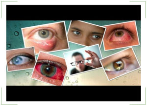 Инфекционные болезни глаз у человека