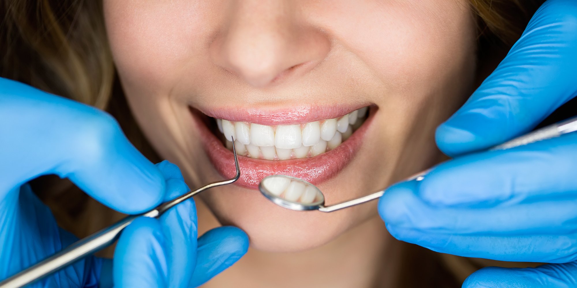 Можно вылечить зубы разом. Гигиена полости рта в стоматологии. Красивые зубы стоматология. Стоматология имплантация зубов. Импланты ортопедическая стоматология.