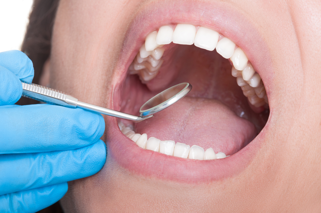 Зубы стоматолог
