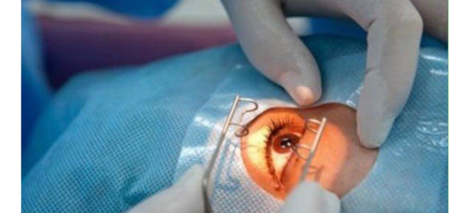 Операция по удалению глаза