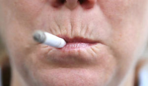 От чего трескаются губы: причины и профилактика
