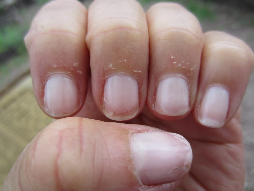 6 правил сделают кожу у ногтей здоровой и без заусенцев