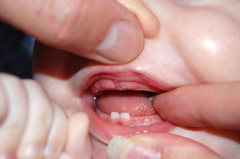 Зубки у ребенка в 4 года thumbnail