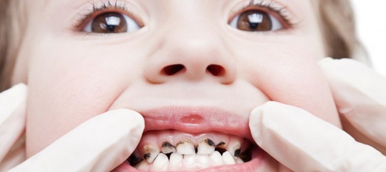 зубы у ребенка