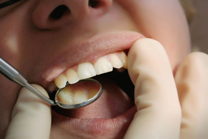 Болят все зубы сразу: что это, как лечить?