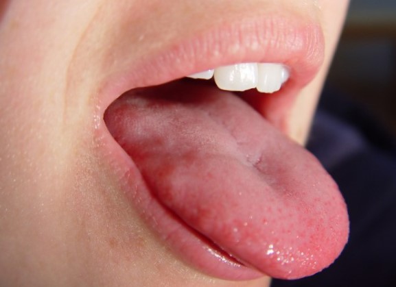 Почему болят боковые участки языка?