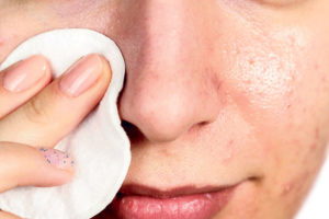 8 безопасных масок устранят пигментацию на вашей коже