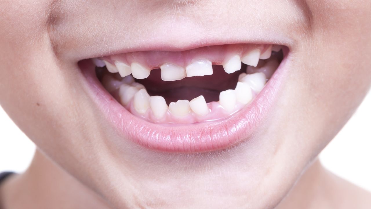 Ровные зубы у детей