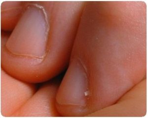 Почему важен уход за кожей возле ногтей