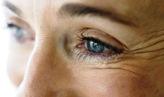 Справиться с «гусиными лапками» и придать здоровье коже вокруг глаз