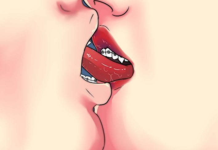 Можно ли целоваться с брекетами на зубах?