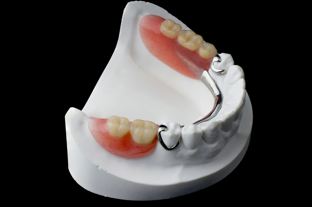 Фото съемных зубных протезов на обе челюсти