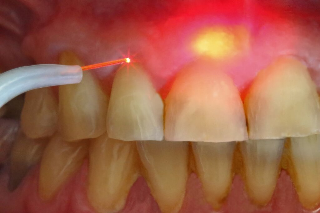 C чего начать лечение зубов?