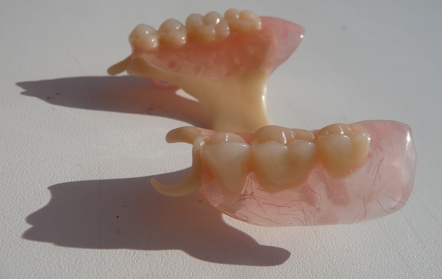 Виды съемных зубных протезов и уход за ними