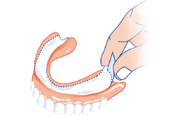 Зубные прокладки под зубные протезы