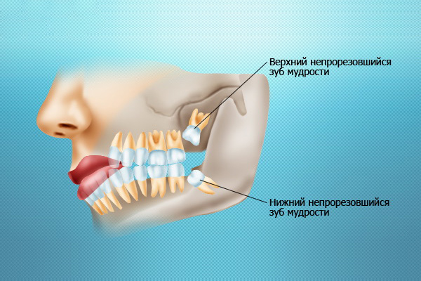Болит челюсть при открытии рта