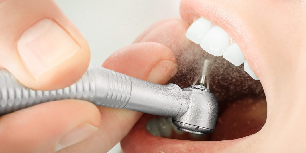 Больно ли ставить пломбу на зуб