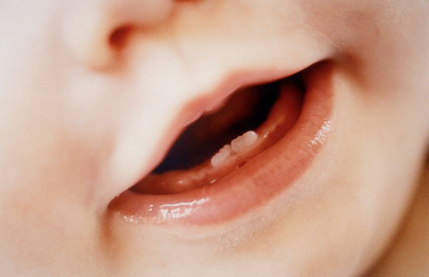 Фото как прорезываются зубы у детей
