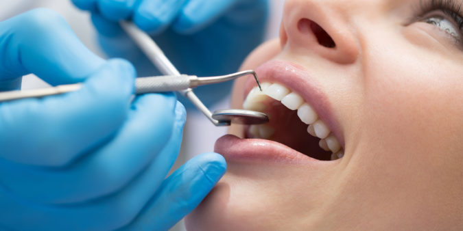 В каких случаях после удаления или лечения зуба может появиться стоматит?