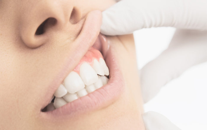 Протезирование зубов врач как называется