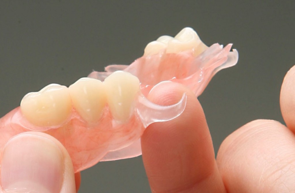 Как происходит ремонт зубных протезов?