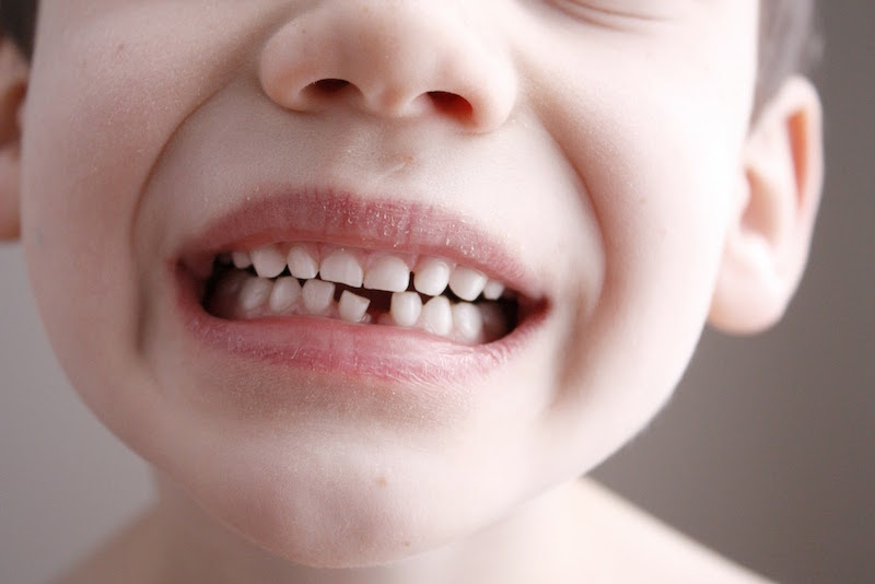 Сколько зубову ребенка в 4 года thumbnail