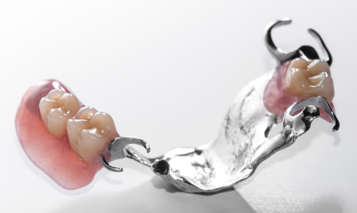 Что собой представляют зубные протезы нового поколения без неба?