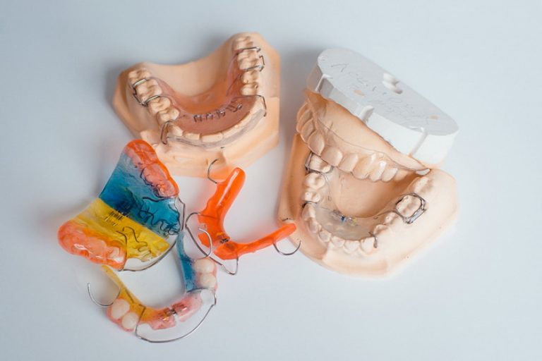 Пластины на зубы: конструкция, преимущества и недостатки, процесс установки