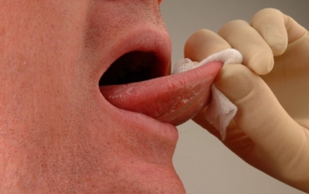 Что делать, если опух язык?