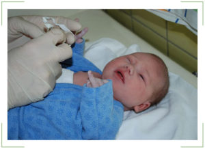 Промывание слезного канала у новорожденного