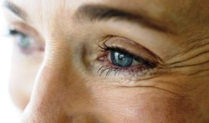 Как правильно ухаживать за кожей вокруг глаз?
