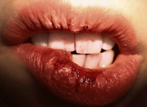 Как побороть привычку кусать губы? 12 советов