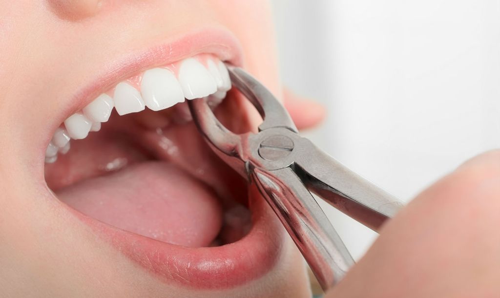 Показания к удалению зуба