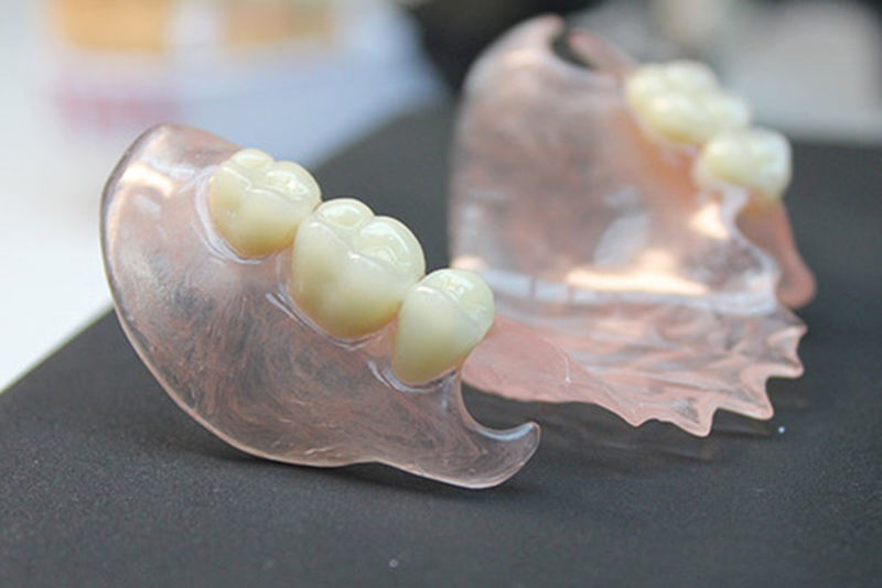 Силиконовые зубные протезы