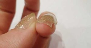 Вред гель-лака для ногтей и кожи вокруг них