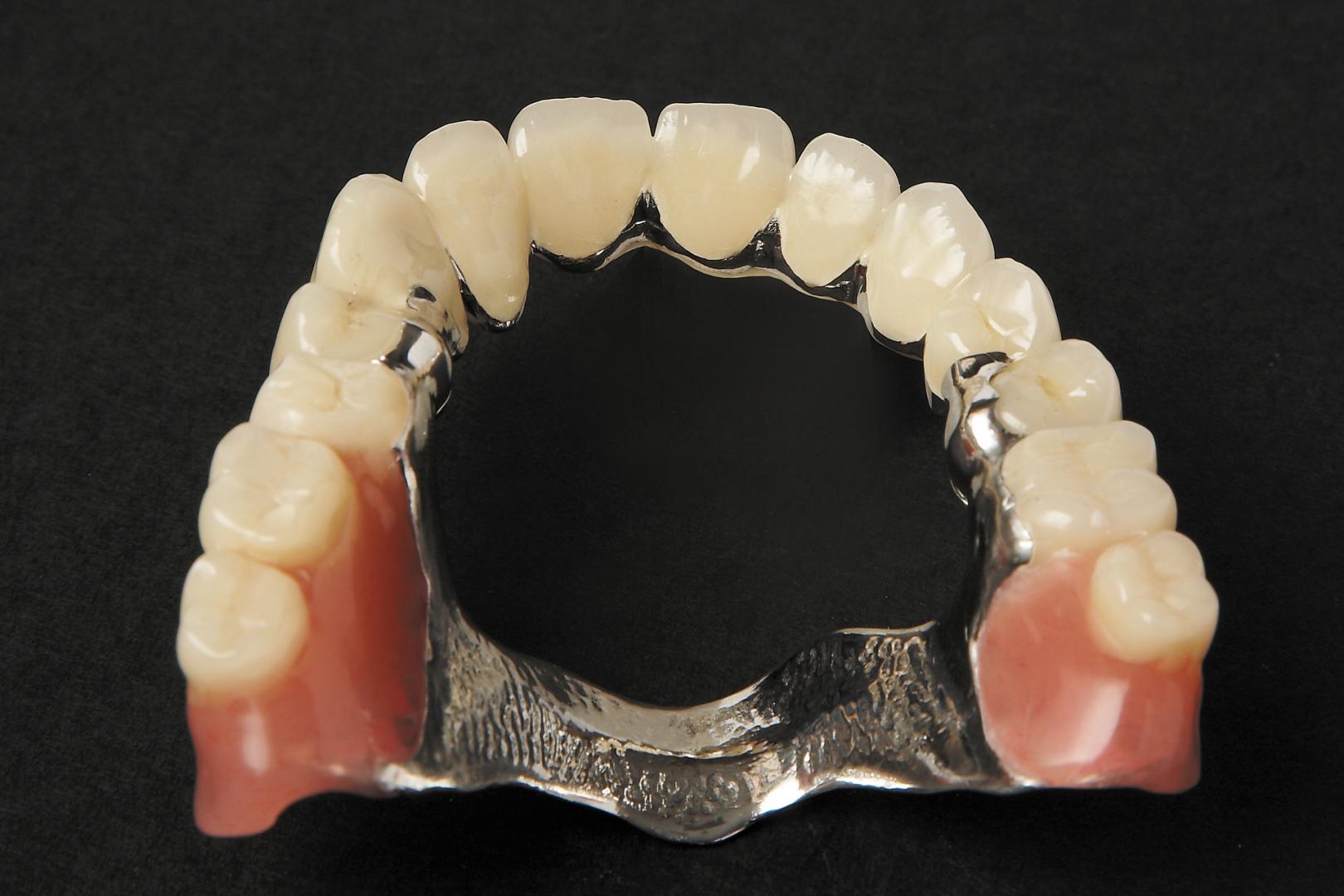 Как осуществляется протезирование зубов?