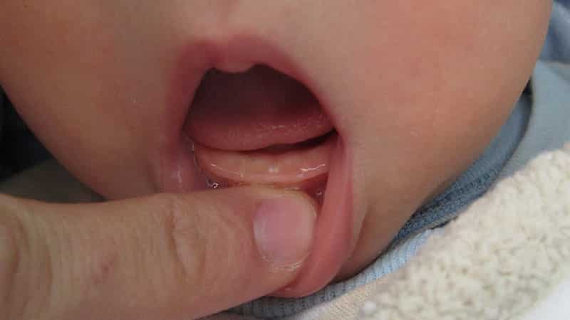 зубы у ребенка