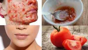 Как уменьшить расширенные поры на лице? Полезные советы для жирной и комбинированной кожи