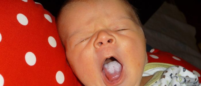 Лечение молочницы у новорожденных во рту